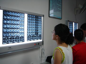 Film asciutto medico asciutto 10in x 12in di X Ray del laser per le stampanti di Fuji