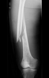 Imaging biomedico del laser X Ray di Konida